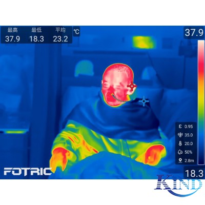 热像仪做体温筛查，对人体有害吗？